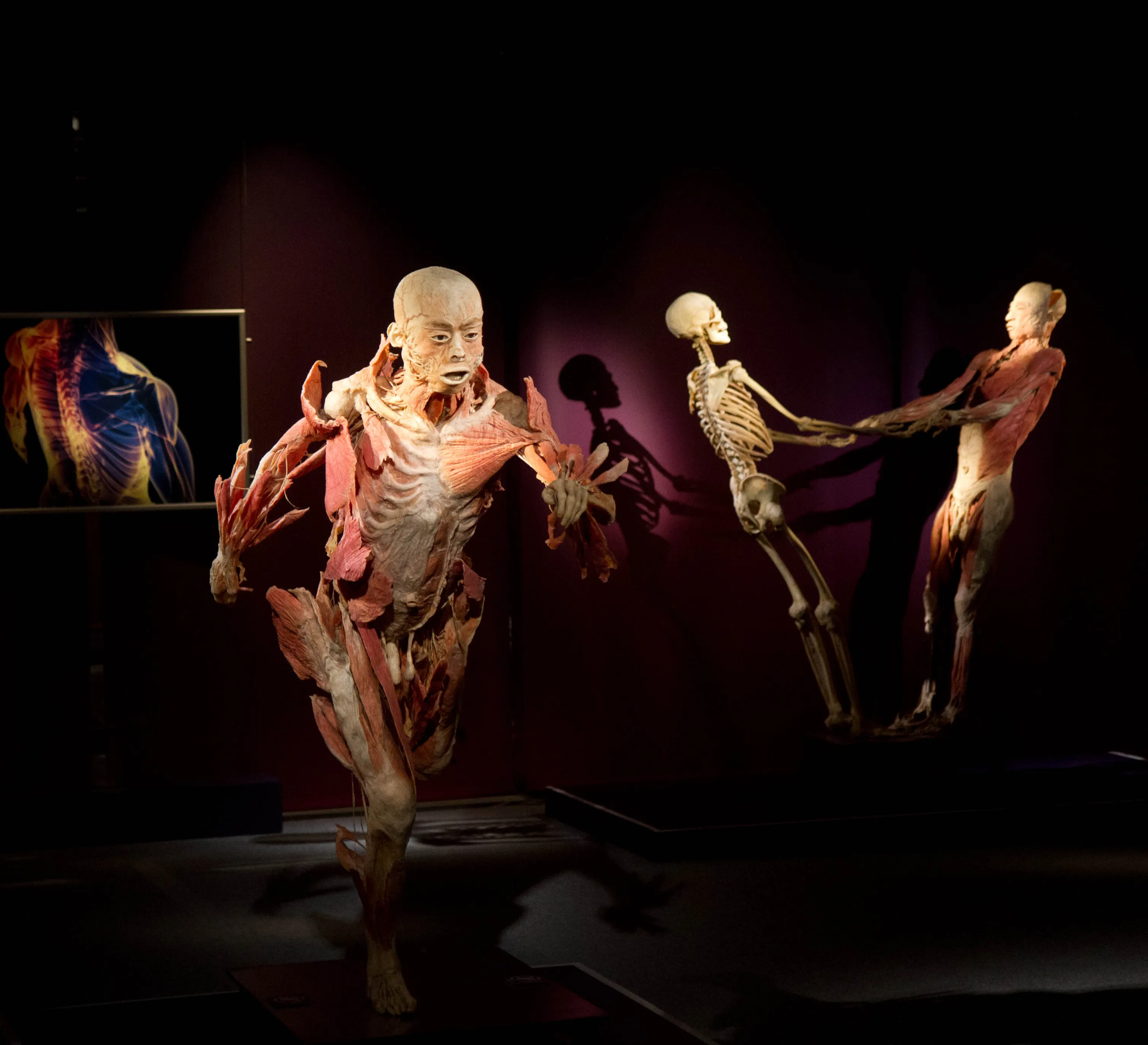 the-human-body-exhibition